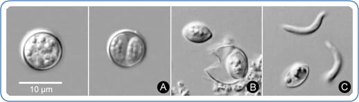 Imágenes de ovoquistes de C. cayetanensis pasando de estado no infeccioso a infeccioso y en proceso de multiplicación. Hay una descripción más amplia a continuación.