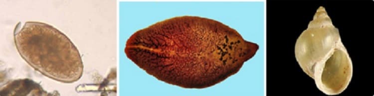 fascioliasis diagnózis példák a tengeri platyhelminthes ra