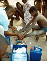 Managing Guinea worm.