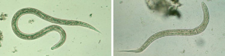 Pinworm hookworm. Pinworm: tünetek és kezelés Kerek és pinworms kezelés felnőtteknél