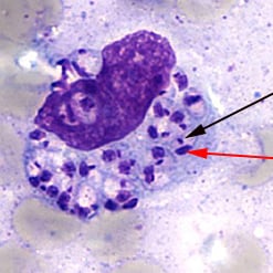 Light-microscopic examination of a stained bone marrow specimen from a patient with visceral leishmaniasis—showing a macrophage (a special type of white blood cell) containing multiple <em>Leishmania</em> <strong>amastigotes</strong> (the tissue stage of the parasite). Note that each amastigote has a <strong>nucleus</strong> (red arrow) and a rod-shaped <strong>kinetoplast</strong> (black arrow). Visualization of the kinetoplast is important for diagnostic purposes, to be confident the patient has leishmaniasis. (Credit: CDC/DPDx)