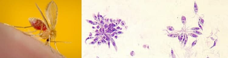 Leishmania paraziták képeket. Leishmania kerekféreg ciszták