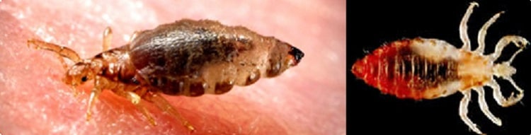CDC - Lice - Body Lice