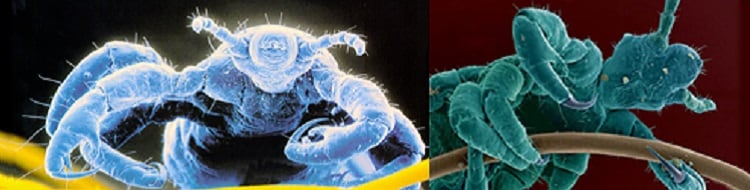 CDC - Lice - Head Lice