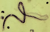 Microfilaria of <em>Wuchereria bancrofti</em> (CDC Photo; DPDx)