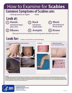 Fact Sheet: How to Examine for Scabies