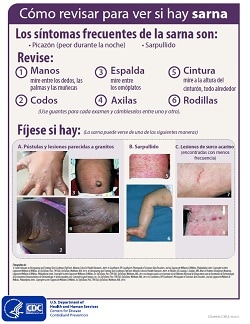 Fact Sheet: How to Examine for Scabies