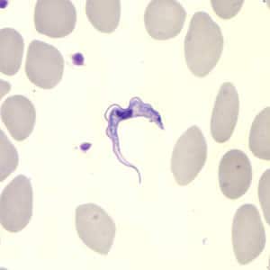 Trypanosoma brucei ssp. in a thin blood smear stained with Giemsa.