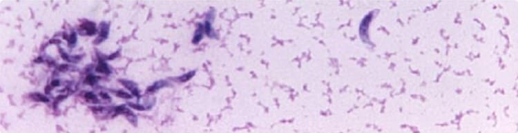 Toxoplasma gondii in mouse ascitic fluid. Smear
