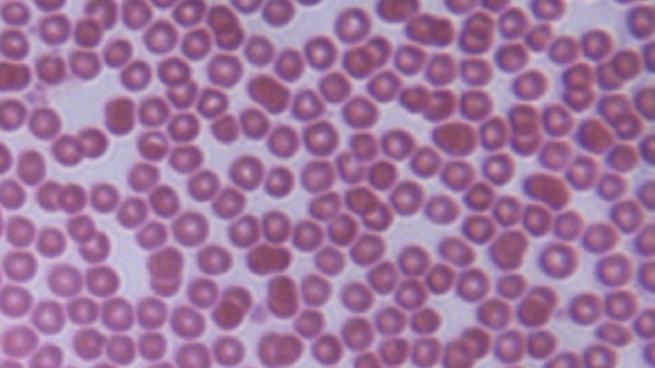 blood cells