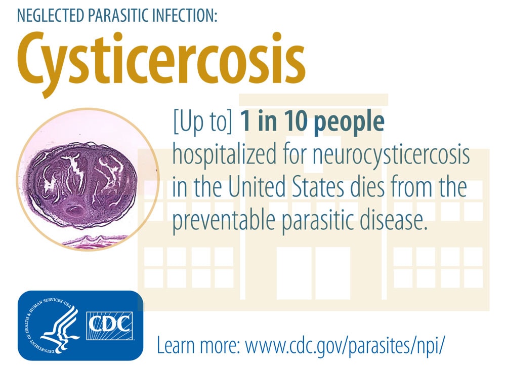 cysticercosis paraziták