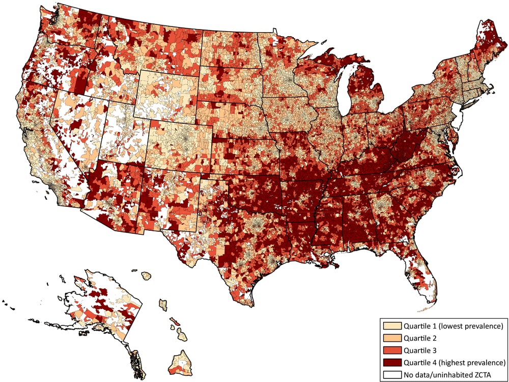 Choropleth map of the US showing the geographic distribution of chronic disease prevalence scores by quartile across Zip Code Tabulation Areas (ZCTAs). Chronic disease prevalence scores ranged from 0 to 20 with a score of 0 meaning the ZCTA was in the 25th percentile and a score of 20 meaning the ZCTA was in the 75th percentile of prevalence for each chronic disease examined.