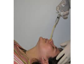 Image showing the proper technique for obtaining a nasopharyngeal specimen for isolation of Bordetella pertussis.