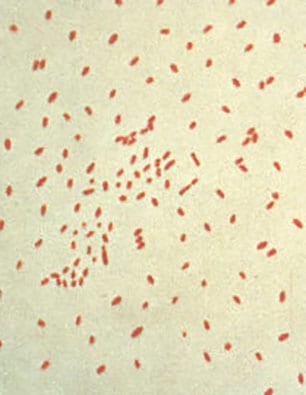 A photomicrograph of Bordetella (Haemophilus) pertussis bacteria using Gram stain technique.