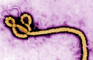 Picture of a single Ebola virus. 