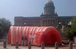 Photo: Inflatable colon