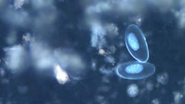 Eggs of E. vermicularis viewed under UV microscopy.