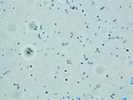 Pneumococcal strain reacting with type-specific antiserum (Quellung reaction) prepared in CDC’s Streptococcus Lab.