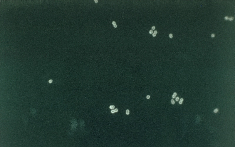 Micrograph depicting Streptococcus pneumoniae bacteria in cerebral spinal fluid using FA staining technique.