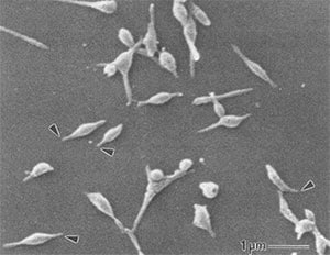 <strong>Electron micrograph of <em>Mycoplasma pneumoniae</em> cells. The arrows indicate the attachment organelles.</strong>

Waites KB, Talkington DF. <a href="http://cmr.asm.org/content/17/4/697.abstract"><em>Mycoplasma pneumoniae</em> and its role as a human pathogen</a>. <em>Clin Microbiol Rev</em>. 2004;17:697–728. doi: 10.1128/CMR.17.4.697-728.2004