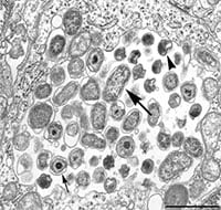 Electron micrograph of Chlamydia psittaci cells.