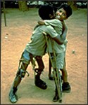 Boys with leg deformities following polio.