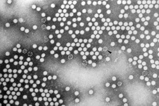 Transmission electron micrograph (TEM) of poliovirus type 1