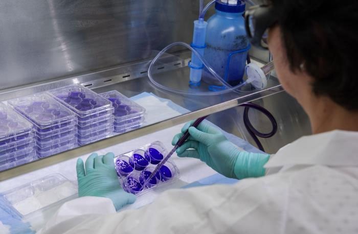 CDC scientist performs a virus plaque assay in the lab to determine the amount of virus in the sample.