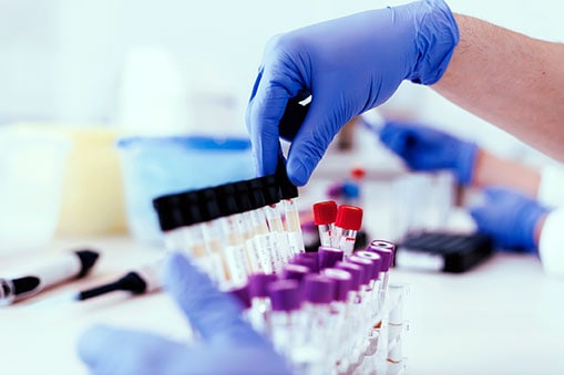Poliovirus Laboratory Testing | CDC
