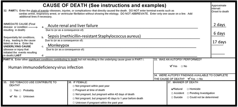 A cause of death form shows the immediate cause is listed as acute renal and liver failure, and the underlying causes are listed as sepsis (methicillin-resistant Staphylococcus aureus) and monkeypox. Under other significant conditions contributing to death but not result in the underlying cause, the form lists human immunodeficiency virus infection.