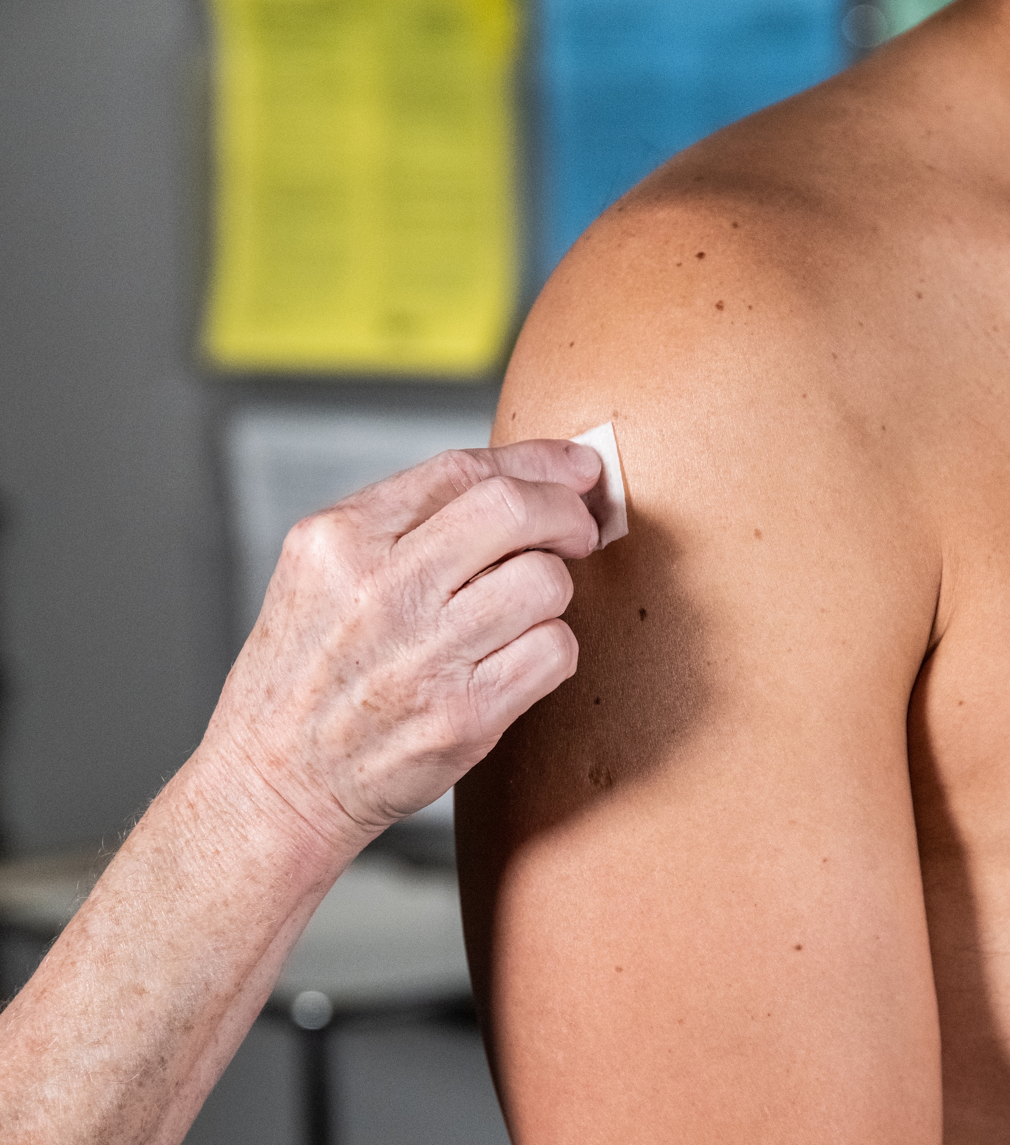 Example of intradermal administration at the deltoid.