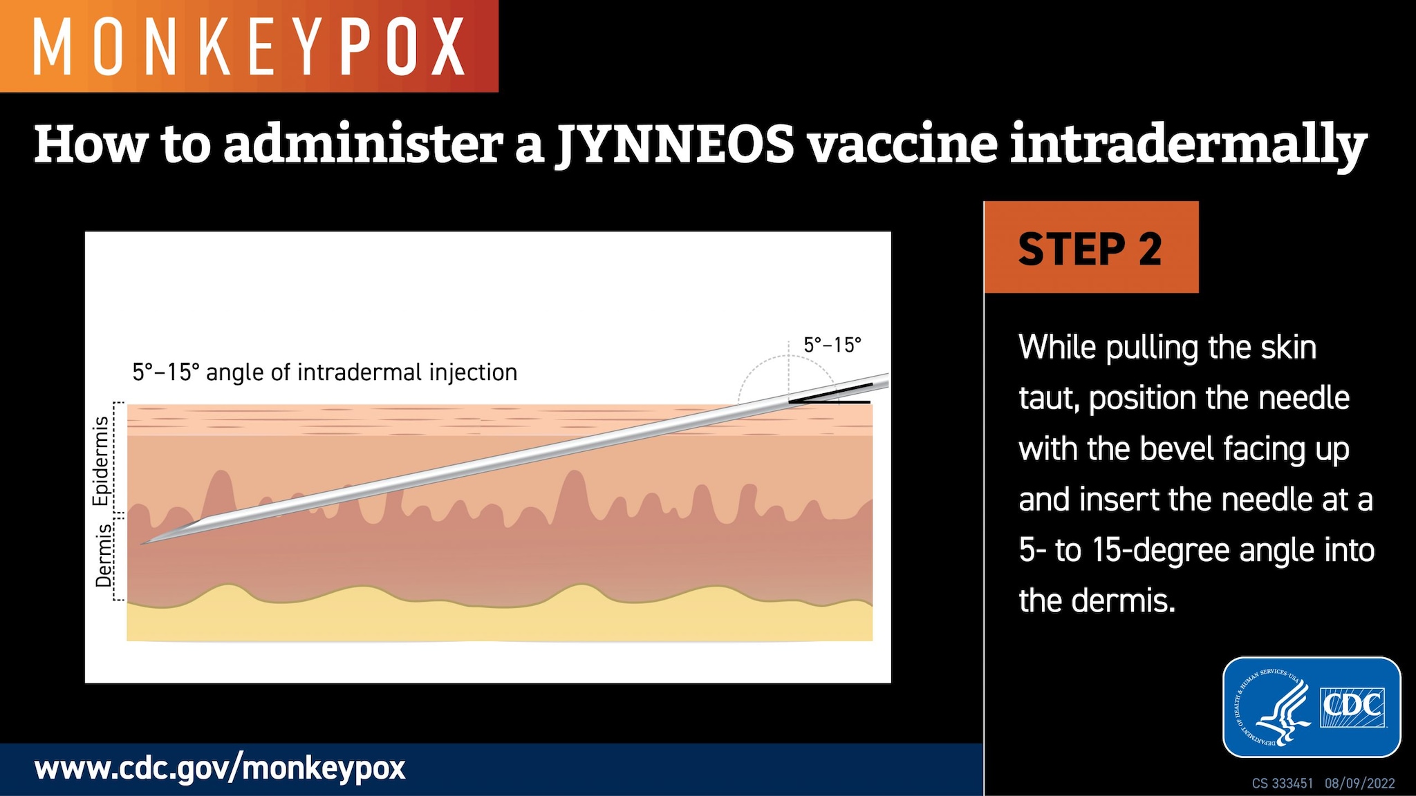 How to administer a Jynneos vaccine intradermally