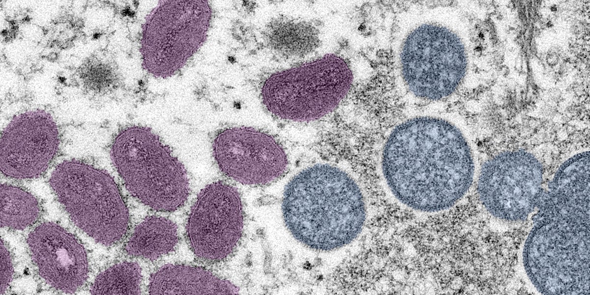 Monkeypox | Poxvirus | CDC
