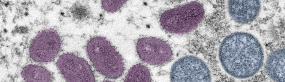 Células de la viruela símica o del mono