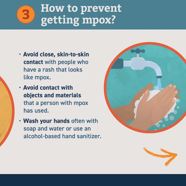 How to prevent getting monkeypox