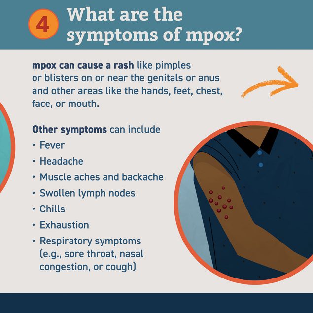 What are the symptoms of mpox?