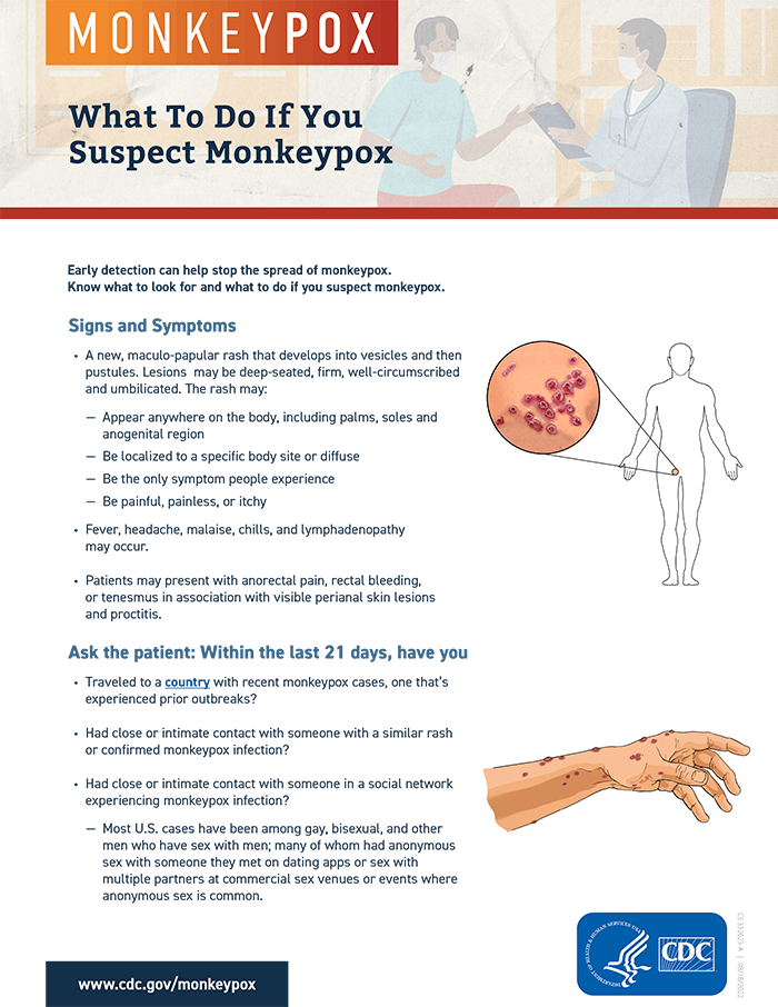 MONKEYPOX. What to do if you suspect Monkeypox. Photo Credit: CDC.gov