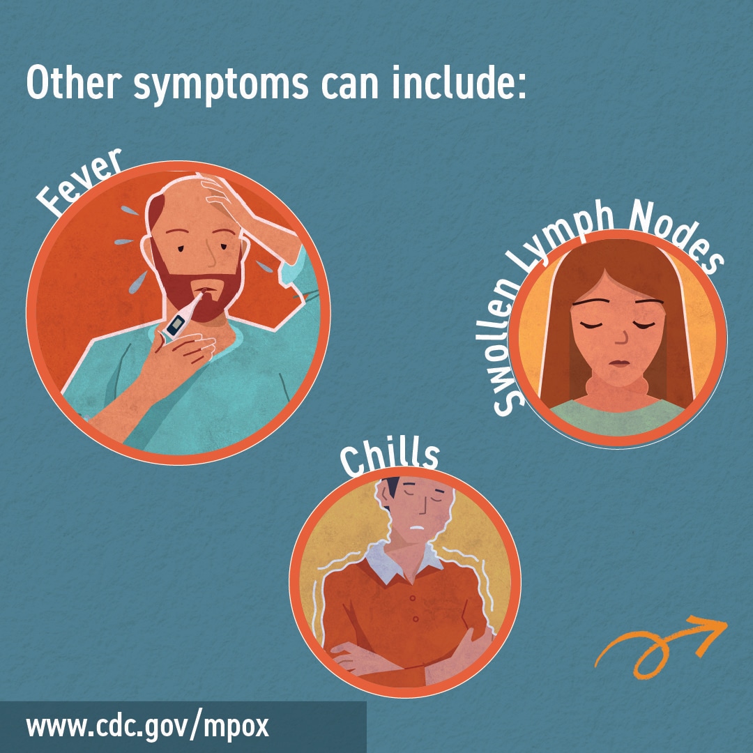 An illustration of examples of mpox symptoms.