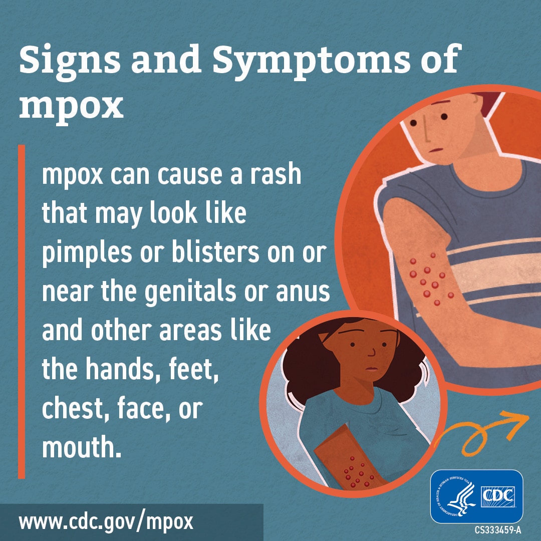 An illustration of a person with a rash on their upper arm and the text, “Signs and symptoms of mpox