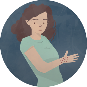Ilustración de una mujer con sarpullido en la mano