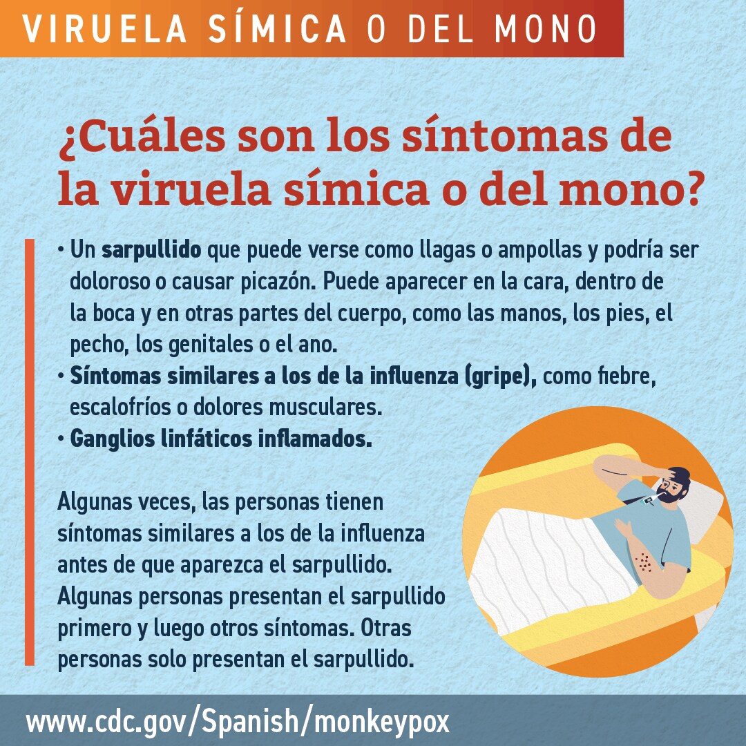 Infographic: ¿Cuáles son los síntomas de la viruela símica o del mono?