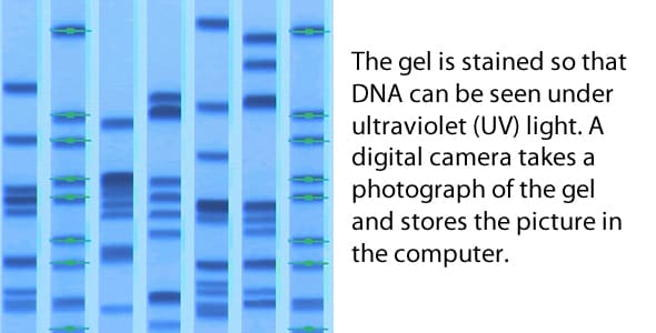 Graphic: The gel is stained so that DNA can be seen under ultraviolet (UV) light. A digital camera takes a photograph of the gel and stores the picture in the computer.