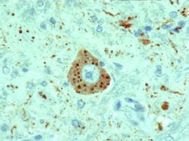 Microscope image of rabies virus-infected neuronal cell