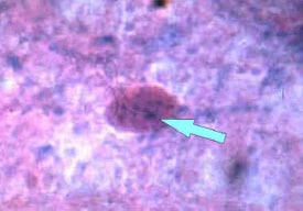 Microscope image of Negri body in Sellers stained brain tissue