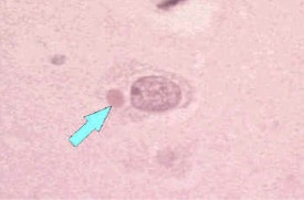 Microscope image of Negri body in infected neuron