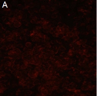 Microscopic image of rabies virus