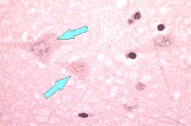 Microscope image of neuron without negri bodies