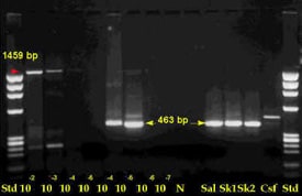 Test result slide for PCR indicating a positions of positive bands