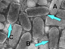 Electron microscope image of negatively stained Rhabdovirus