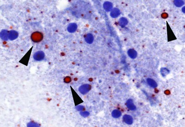 Rabies virus antigen appears as magenta inclusions (arrowheads) against the blue neuronal hematoxylin counterstain.